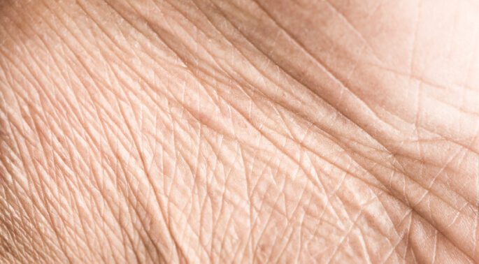 Close up of aged skin